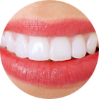 Zahnästhetik Zahnästhetik